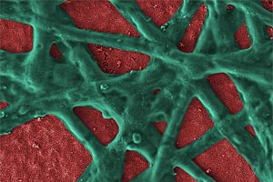 Foto: dr. e. vitol, argonne national laboratory