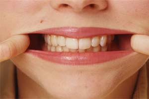 foto: photodisc