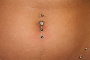 Bauchnabelpiercings sind bei Mädchen zwischen 14 und 20 Jahren besonders beliebt. 