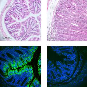 Durchlässige Schutzbarriere: Fehlt das abdichtende Protein E-Cadherin (hellgrün), entstehen Darmentzündungen (Bilder rechts). Durchlässige Schutzbarriere: Fehlt das abdichtende Protein E-Cadherin (hellgrün), entstehen Darmentzündungen (Bilder rechts).