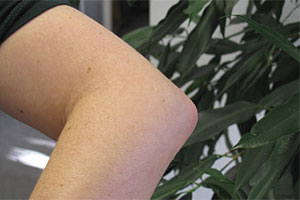 An einem Tennisarm laborieren meist Hobbyspieler. Sind die Sehnen erst
einmal angegriffen, sind Massage und Schonung angesagt. Eine Operation
ist die letzte Option. An einem Tennisarm laborieren meist Hobbyspieler. Sind die Sehnen erst
einmal angegriffen, sind Massage und Schonung angesagt. Eine Operation
ist die letzte Option.
