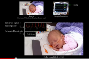 Mit der neuen Software könnte wissensbasiertes Monitoring eine neue Dimension erreichen. Mit der neuen Software könnte wissensbasiertes Monitoring eine neue Dimension erreichen.