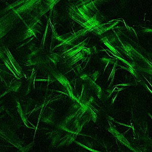 Das Multiphotonenmikroskop zeigt Kollagenfasern in der äußersten Schicht einer menschlichen Aorta. Das Multiphotonenmikroskop zeigt Kollagenfasern in der äußersten Schicht einer menschlichen Aorta.