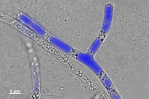 Gütertransport im Mikrometer-Breich: Im Inneren des Myzel-bildenden Pseudopilzes Pythium ultimum bewegen sich (blau dargestellt) mit Phenanthren angereicherte Bläschen.