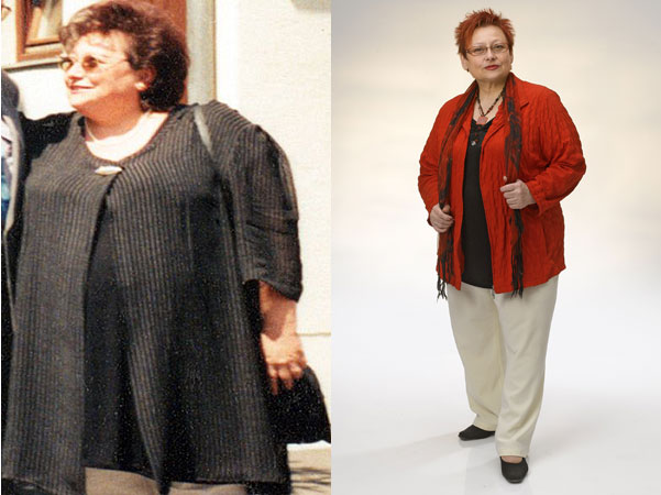 Grund war auch ihre Selbsterfahrung: "Ich hatte mich davor von 115 auf 148 Kilogramm hinaufdiätet, bei diesem Höchststand (Bild l., Anm.) unterzog ich mich einer Bypass-OP. Heute wiege ich konstante 85 Kilogramm." 