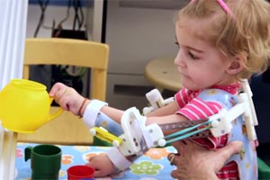Gedruckte Armstützen ermöglichen der zweijährigen Emma ein selbstständiges Spielen.