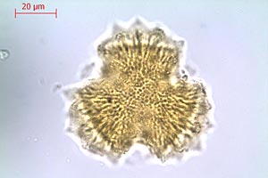 Der Pollen (unter dem Durchlichtmikroskop) stammt von Onopordum alexandrinum, einer Distelart aus dem Nahen Osten, die Steppenklima anzeigt. Der Pollen (unter dem Durchlichtmikroskop) stammt von Onopordum alexandrinum, einer Distelart aus dem Nahen Osten, die Steppenklima anzeigt.
