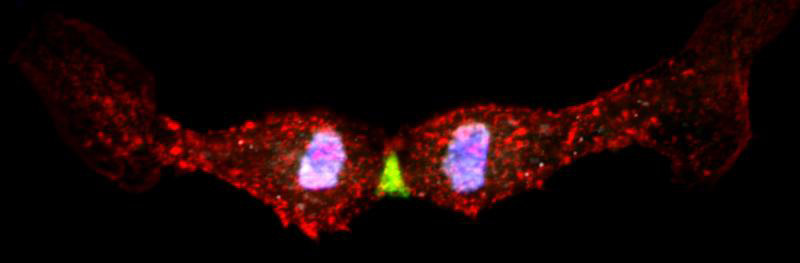Eine  sich teilende embryonale Herzmuskelzelle unter dem Mikroskop - der Mittelkörper ist durch das GFP-Anillin-Signal grün markiert.