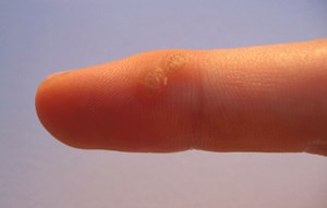 Die Maske für die Person ist otbeliwajuschtschaja stark