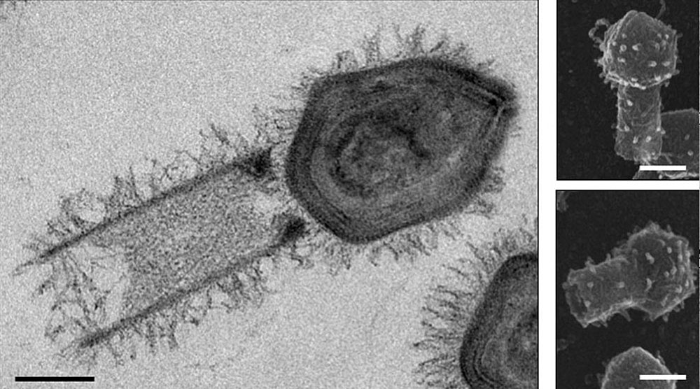 Neu entdecktes Riesenvirus an der Grenze zum Lebewesen