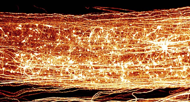 Ultramikroskop macht Rückenmark durchsichtig Technik derStandard.at