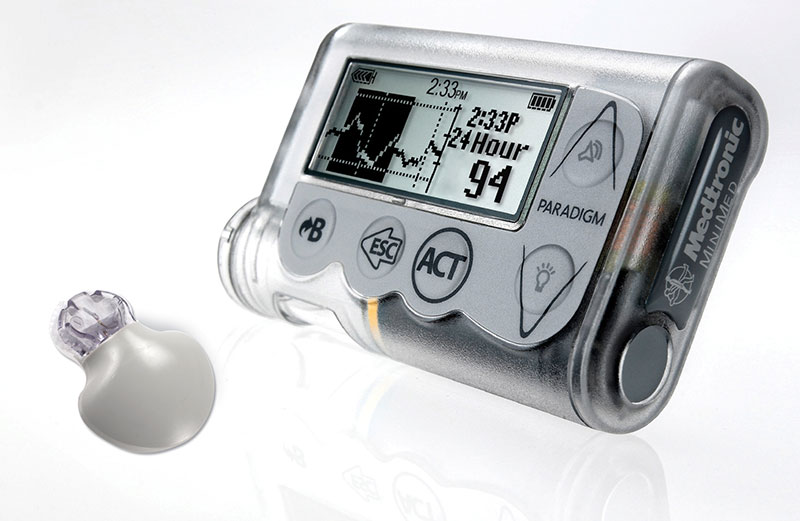 Erstmals bewiesen: Insulinpumpe hilft auch Typ-2-Diabetikern - Diabetes - derStandard.at ...
