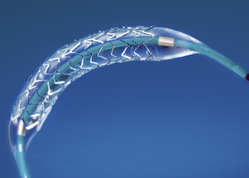 Zeitbomben in der Aorta Stents gegen Aneurysmen Innere Organe derStandard.at
