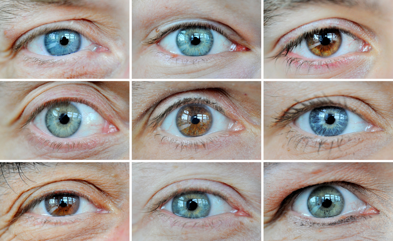 Krankheiten in den Augen erkennen - Augen - derStandard.at › Gesundheit