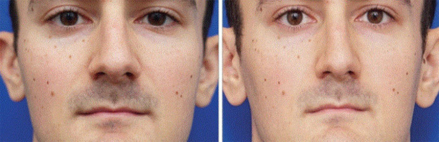 Mehr Schonheits Ops Weil Nasen Auf Selfies Unnaturlich Gross Wirken Mensch Derstandard De Wissen Und Gesellschaft