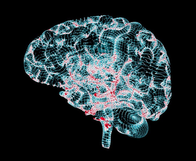 Parkinson Krankheitsverlauf Parkinson Krankheitsverlauf