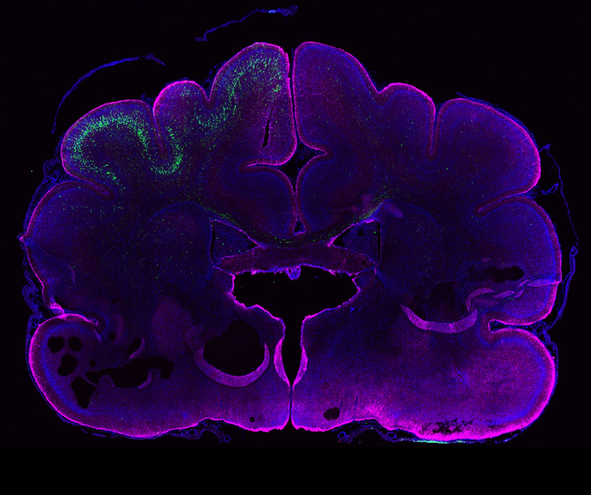 Menschliches Gen vergrößert im Experiment Gehirn von Frettchen