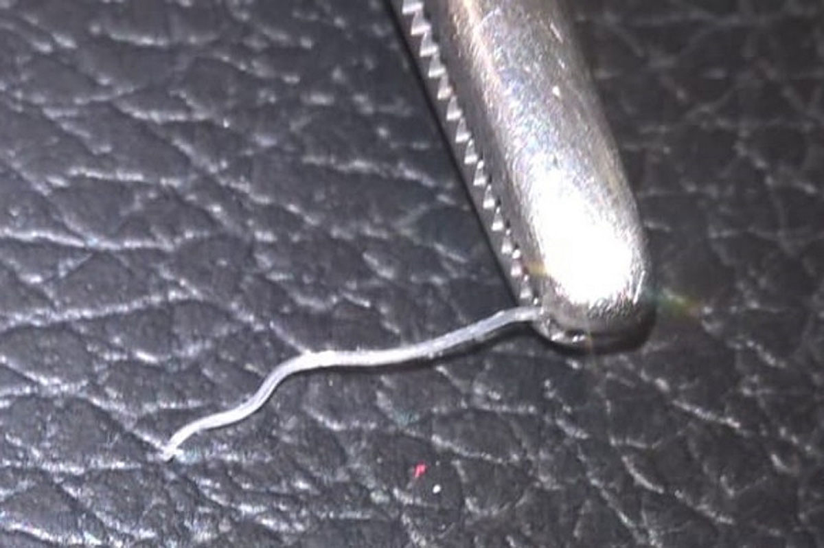 Erste Osterreichische Katze Mit Orientalischem Augenwurm