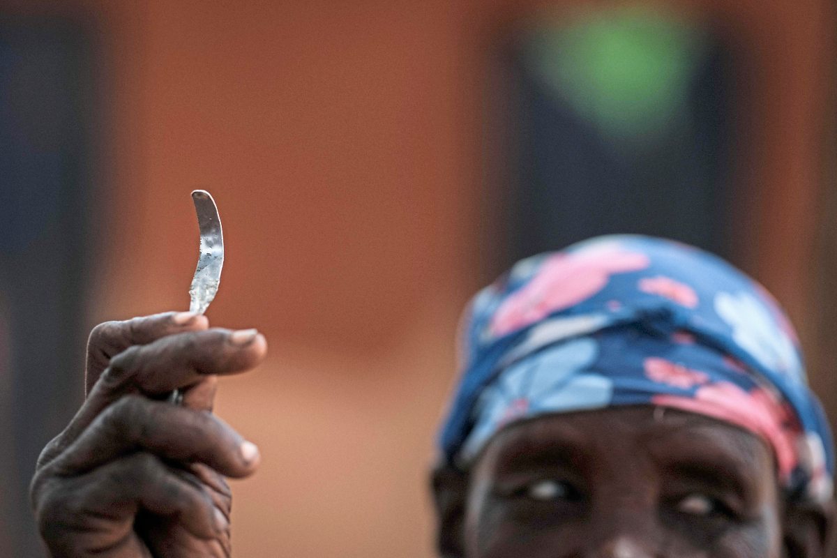 Die Kontrolle Uber Den Korper Wegschneiden Diestandard Derstandard De Wissen Und Gesellschaft