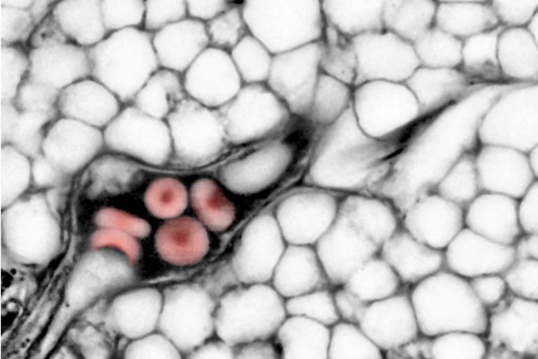 Forscher Verbessern Lichtmikroskopie Forschung Derstandard De Wissen Und Gesellschaft